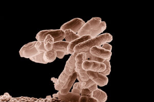 Бактериальные заболевания были смертельной угрозой в каменном веке